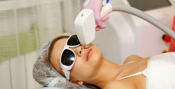 Depilazione laser del labbro superiore (antenne) nelle donne. Quante sessioni sono necessarie, come si fa
