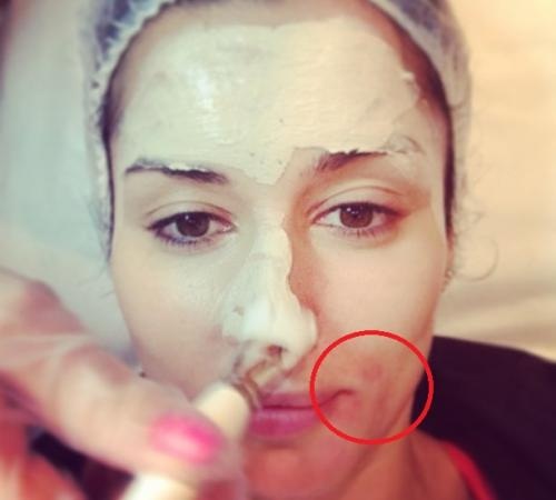 Tina Kandelaki. Foto, com es veu en un banyador, abans i després de la cirurgia plàstica, sense maquillatge, photoshop