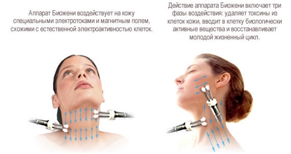 Tratamiento facial biogeous. Fotos de antes y después, efectos, precio, reseñas
