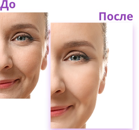 Biogeöse Gesichtsbehandlung. Vorher und nachher Fotos, Effekte, Preis, Bewertungen