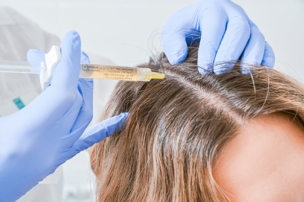 Dermahil para cabelos em mesoterapia. Composição, fotos antes e depois, instruções de uso