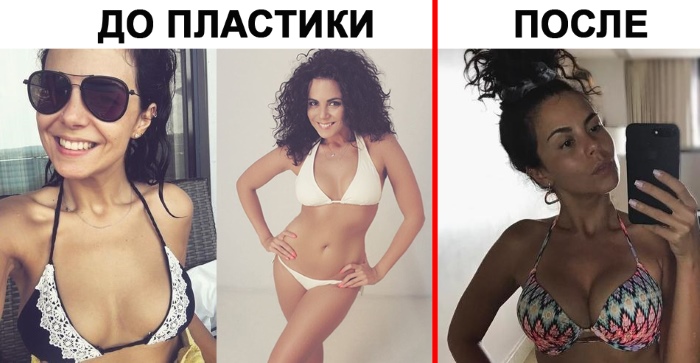Nastya Kamenskikh. Photo en maillot de bain, sans maquillage, avant et après chirurgie plastique, vie personnelle