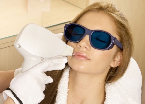 Neodymium laser voor het verwijderen van gezichts- en lichaamshaar. Voor en na foto's, prijs, recensies