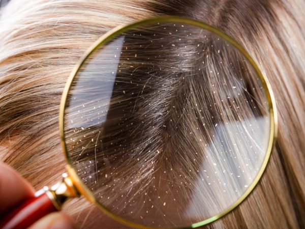 Σαμπουάν για ξηρά μαλλιά. Ποιο είναι καλύτερο, πώς να χρησιμοποιήσετε, τιμές και κριτικές