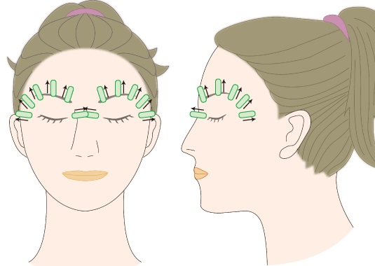 Face taping. Technique, instructions at home, video tutorials