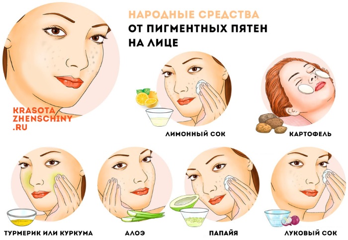 إزالة التصبغ من الوجه في المنزل بسرعة. الكريمات والعلاجات الشعبية