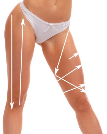 Massage chân không với lon cho cellulite trên bụng và hai bên. Hình ảnh, đánh giá, cách làm đúng