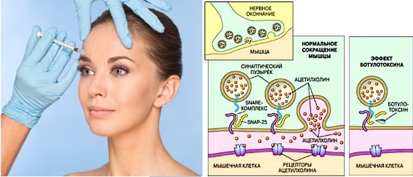Refinex dalam bidang kosmetologi. Kecekapan, kesan sampingan penggunaan, ulasan pakar kosmetik