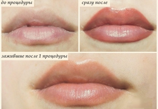 Tatuaggio sulle labbra. Foto prima e dopo, conseguenze, recensioni