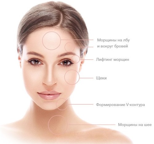 Terapi Ulthera (Altera) dalam kosmetologi perkakasan. Sebelum dan selepas gambar, harga, ulasan
