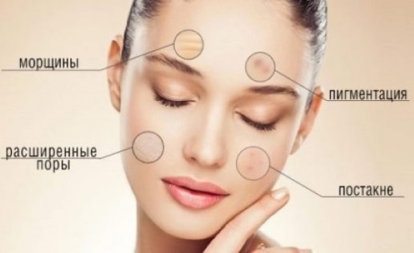 Laser erbowy w kosmetologii. Zdjęcia przed i po, wyniki aplikacji, recenzje