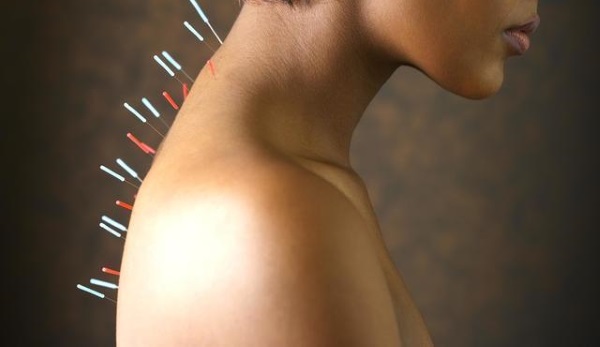 Akupunktur zur Gewichtsreduktion. Wie es im Ohr, am Körper, die Vorteile und Nachteile der Akupunktur gemacht wird, Bewertungen