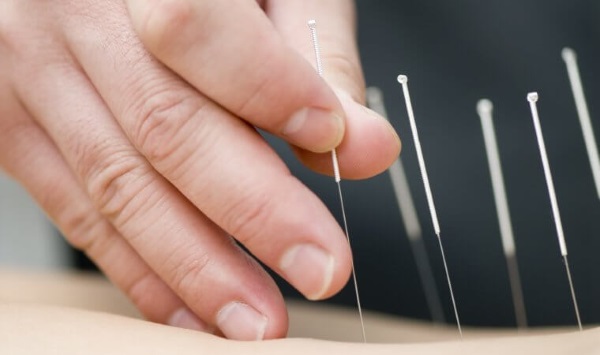 Akupunktura na odchudzanie. Jak to się robi w uchu, na ciele, korzyści i szkody akupunktury, recenzje