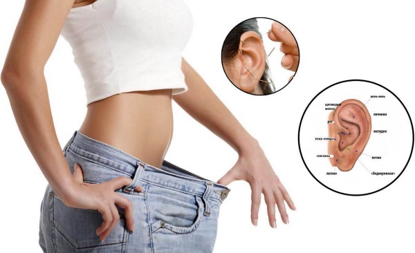 Acupuncture for weight loss. How it is done in the ear, on the body, the benefits and harms of acupuncture, reviews