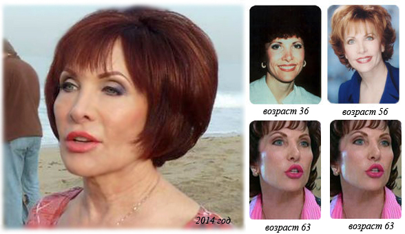 Facelift for the face. Effective exercises, anti-puffiness techniques, for tightening the oval, before and after photos
