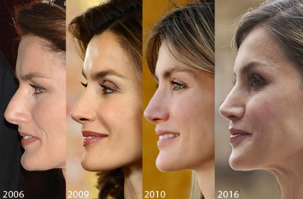 Reina Letizia de España. Fotos antes y después de la cirugía plástica, altura y peso, parámetros.