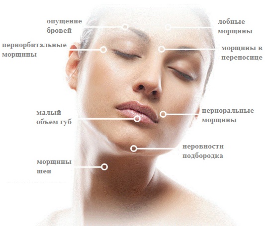 Botulax (Botulax): recenzje kosmetologów, cena, instrukcje użytkowania