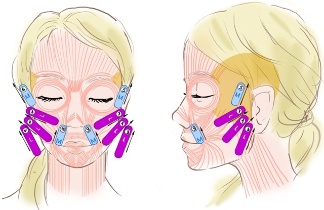 Làm thế nào để dán băng dính trên khuôn mặt của bạn một cách chính xác. Bấm mí cho các nếp nhăn, túi dưới mắt. Một bức ảnh