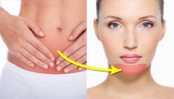 Mapa de acné en el rostro de la mujer, cuello, cuerpo. ¿Qué significan las razones por zonas, órganos?
