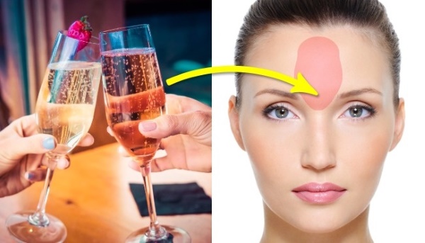 Mapa de l'acne a la cara de les dones, coll, cos. Què signifiquen els motius per zones, òrgans