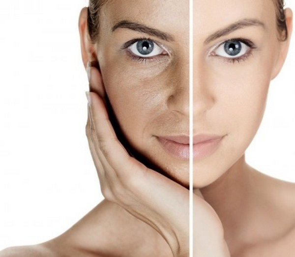 Nettoyage de la peau du visage au laser. Prix ​​de blanchiment, rajeunissement, contre-indications