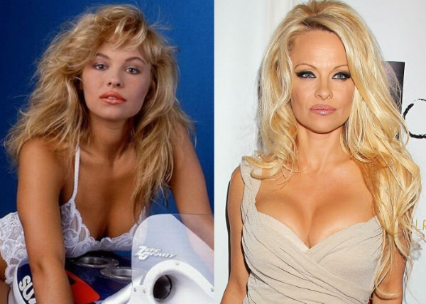 Pamela Anderson. Fotos en su juventud, ahora, Playboy, antes y después de la cirugía plástica, biografía, vida personal.