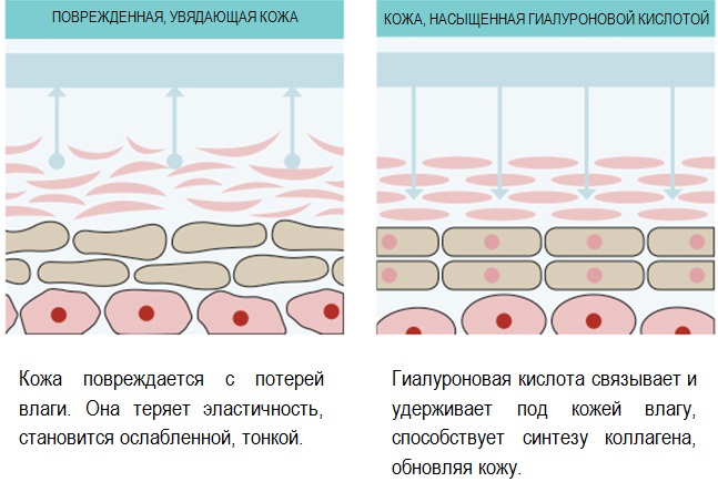 Botox tương tự cho da mặt do Nga sản xuất, Pháp, Hàn Quốc. Xeomin, Dysport, Relatox