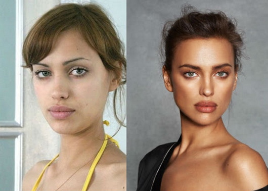 Irina Shayk. Fotos quentes em maiô, antes e depois da cirurgia plástica, biografia
