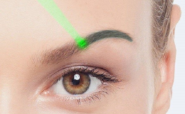 Pag-alis ng laser ng permanenteng makeup (tattoo) ng eyebrows, labi, eyelids