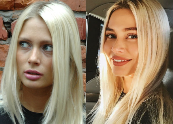 Natalya Rudova antes e depois da cirurgia plástica, fotos gostosas em maiô, biografia