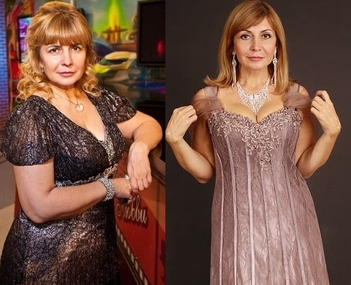 Irina Agibalova. Fotos før og efter operationen, vægttab