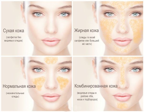 Types de peau en cosmétologie. Classification, critères de détermination, photo